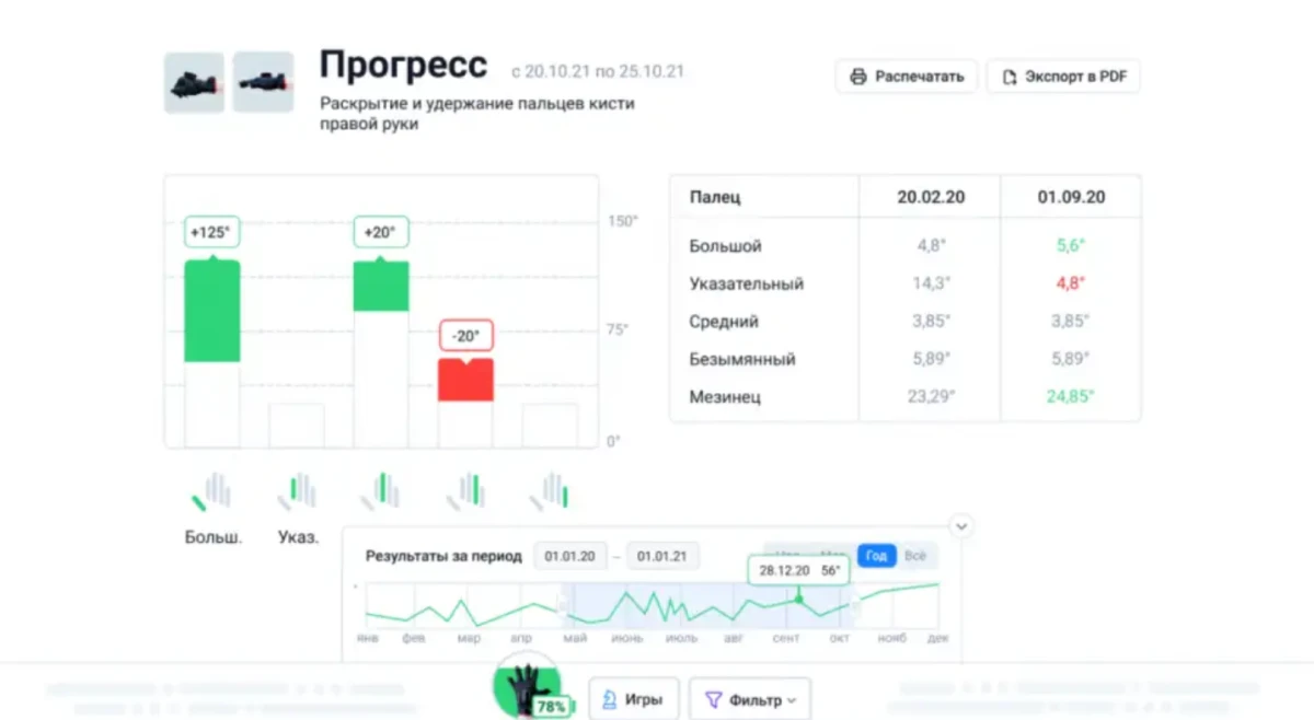 Реабилитационная перчатка - тренажер SensoRehab